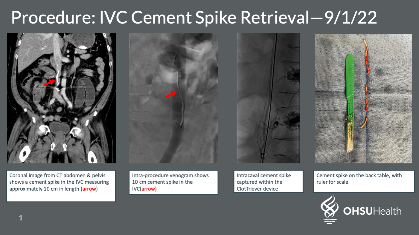 Hillsboro Medical Center Introduces Interventional Radiology Services